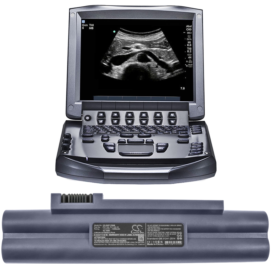 Medical Battery Sonosite CS-SUP170NB